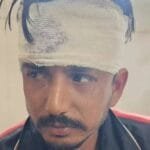 चिड़ावा में ड्यूटी पर तैनात सफाईकर्मी पर जानलेवा हमला, सिर पर गहरी चोट — सफाईकर्मी वर्ग में आक्रोश A sanitation worker on duty in Chirawa was attacked with a fatal head injury – anger among sanitation workers